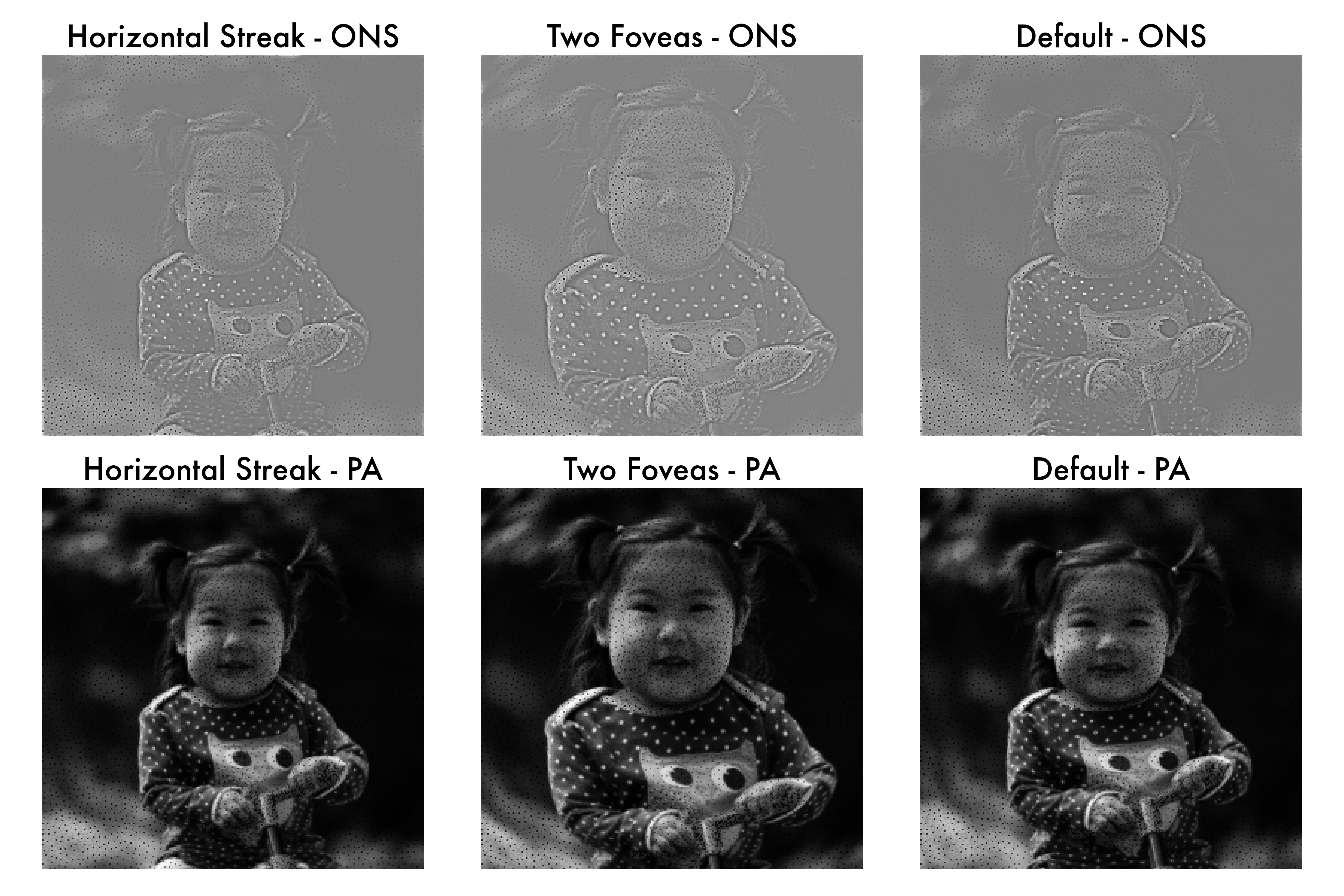 Comparison of retinal responses